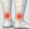 do compression socks help with shin splints